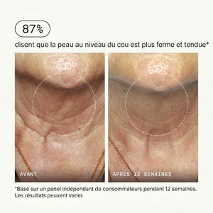 Micro-Infusion Lift Pro®